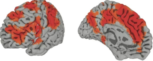 BOLD activation on inflated cortical surfaces