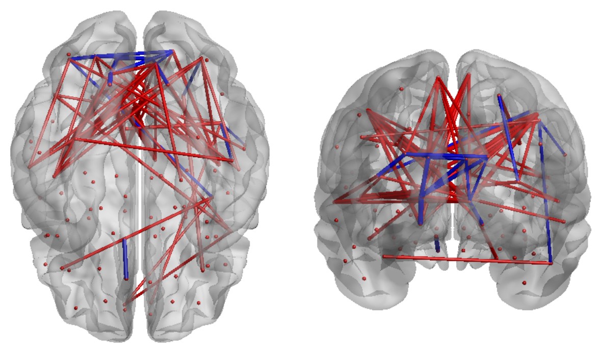 Glass-brain functional connectivity plot showing connections between brain regions
