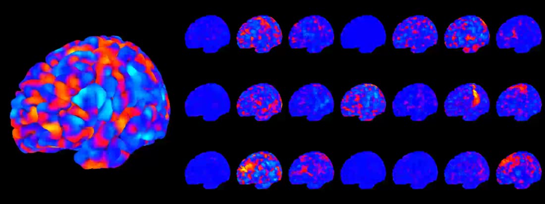 Independent component analysis of resting-state fMRI networks